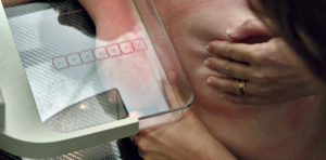 Mammografiscreening redder liv